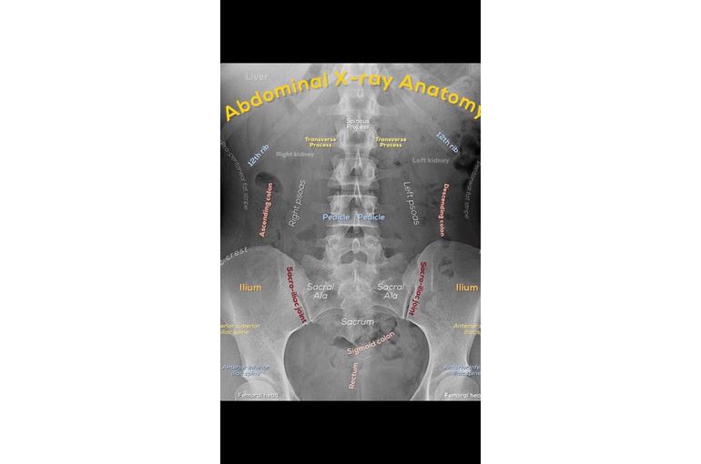 91ED3FE8-1E71-45D6-8A6D-89360577097A